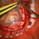 Illustration for article titled Transparent skull implant is the next step in body mods (and medicine)